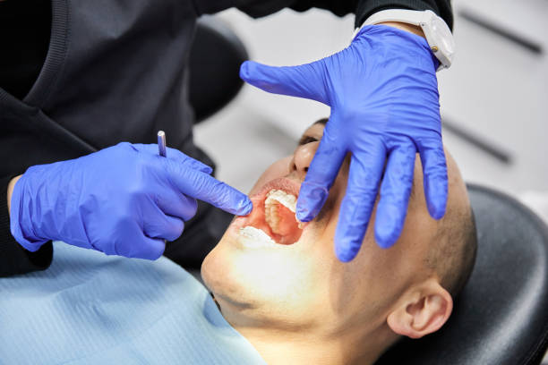 Best Emergency Dentist for Lost Fillings or Crowns in Selmer, TN